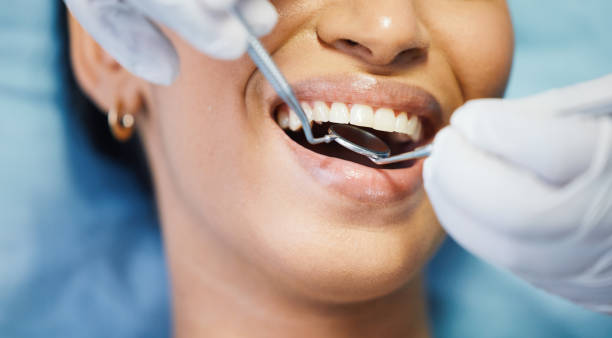 Best Emergency Dental Care for Broken or Chipped Teeth in Hartford, WI